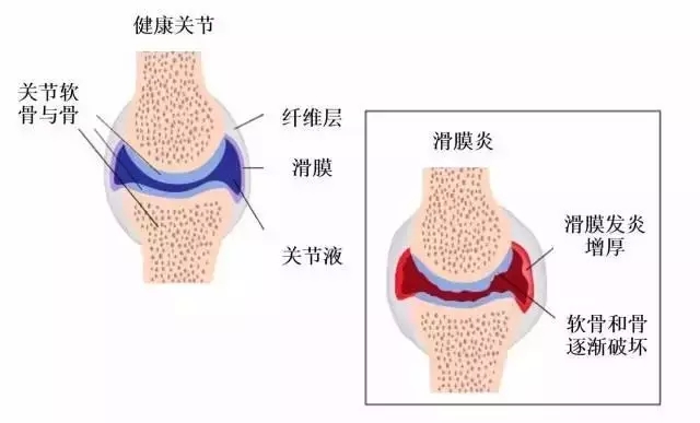 听说今天十几度，真的不用穿秋裤？