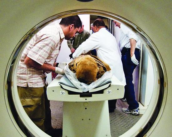 我们现在之所以活得久，多亏了祖先不吃熟肉