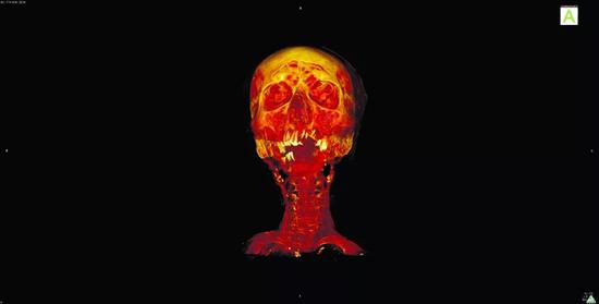 我们现在之所以活得久，多亏了祖先不吃熟肉